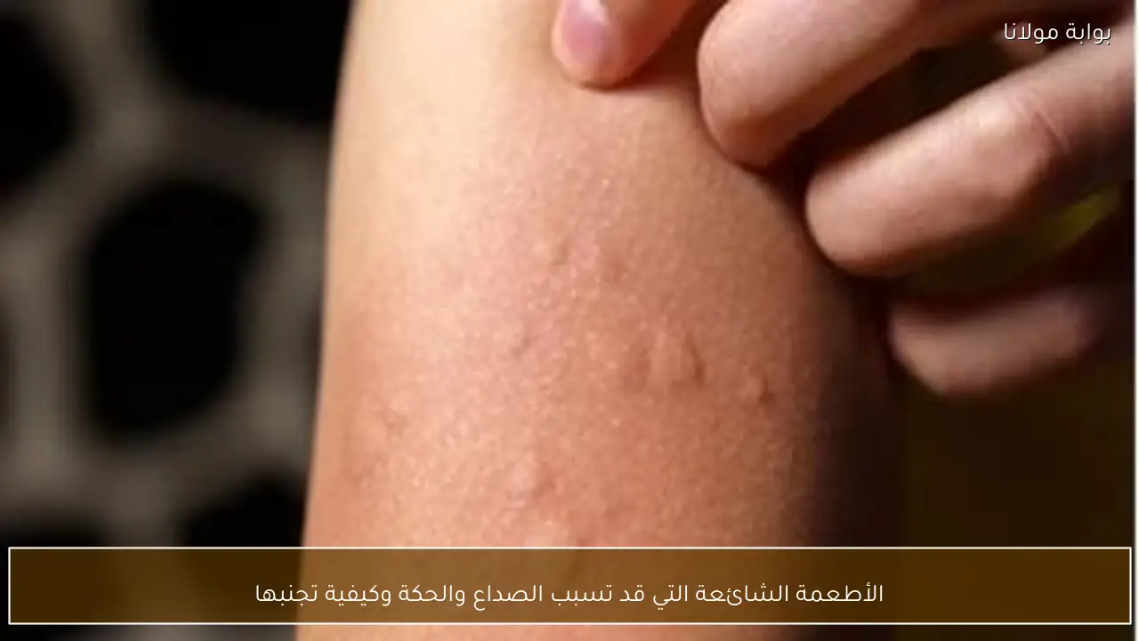 الأطعمة الشائعة التي قد تسبب الصداع والحكة وكيفية تجنبها