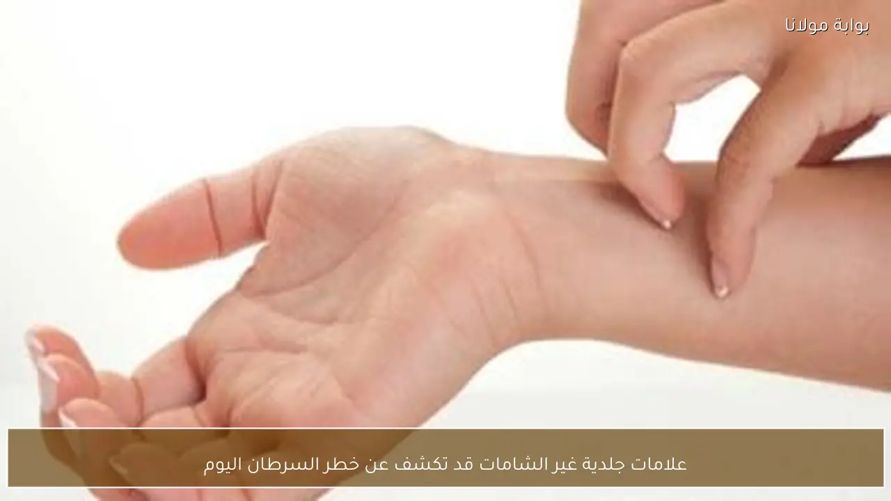 علامات جلدية غير الشامات قد تكشف عن خطر السرطان اليوم