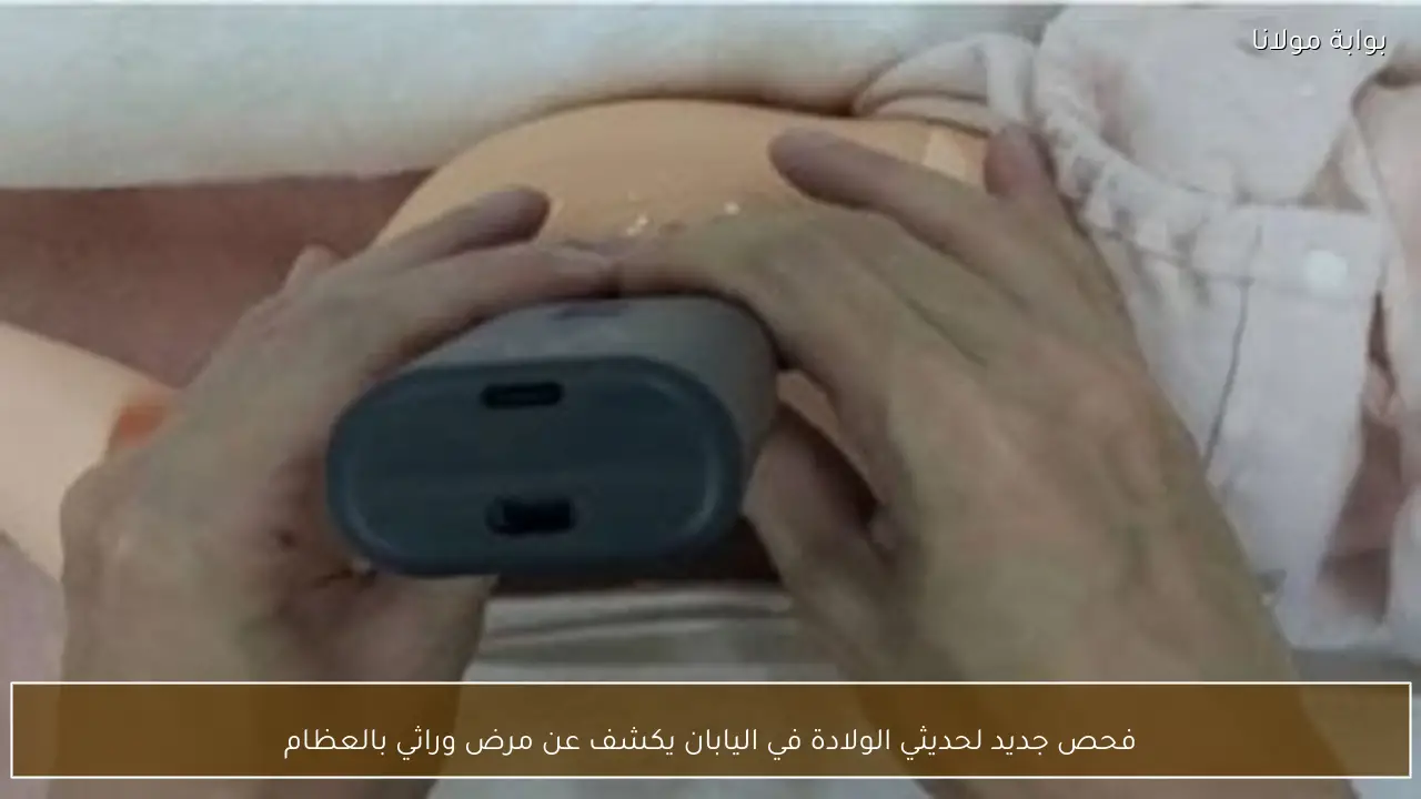 فحص جديد لحديثي الولادة في اليابان يكشف عن مرض وراثي بالعظام