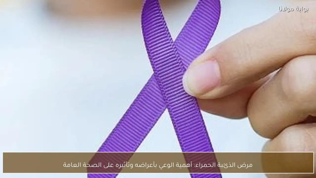 مرض الذئبة الحمراء: أهمية الوعي بأعراضه وتأثيره على الصحة العامة