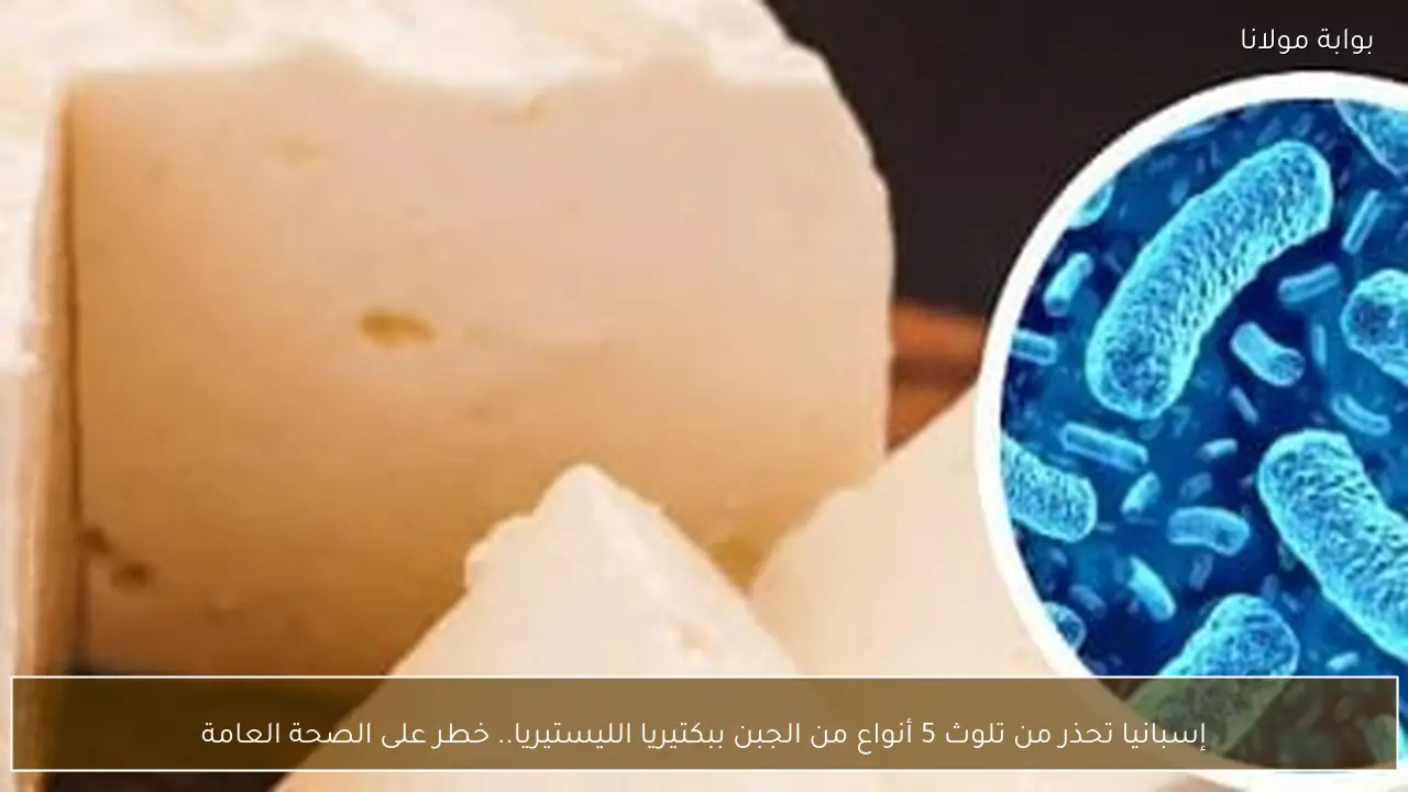 إسبانيا تحذر من تلوث 5 أنواع من الجبن ببكتيريا الليستيريا.. خطر على الصحة العامة