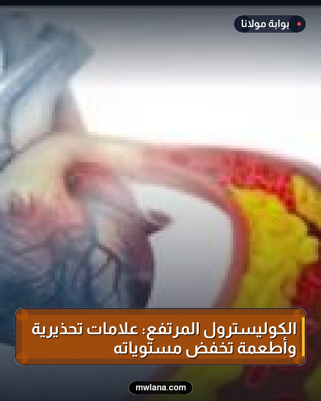 الكوليسترول المرتفع: علامات تحذيرية وأطعمة تخفض مستوياته