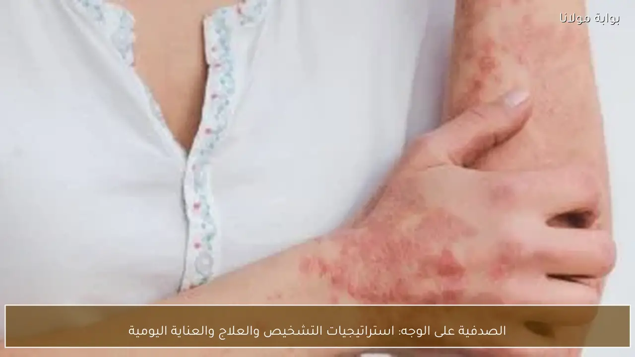 الصدفية على الوجه: استراتيجيات التشخيص والعلاج والعناية اليومية