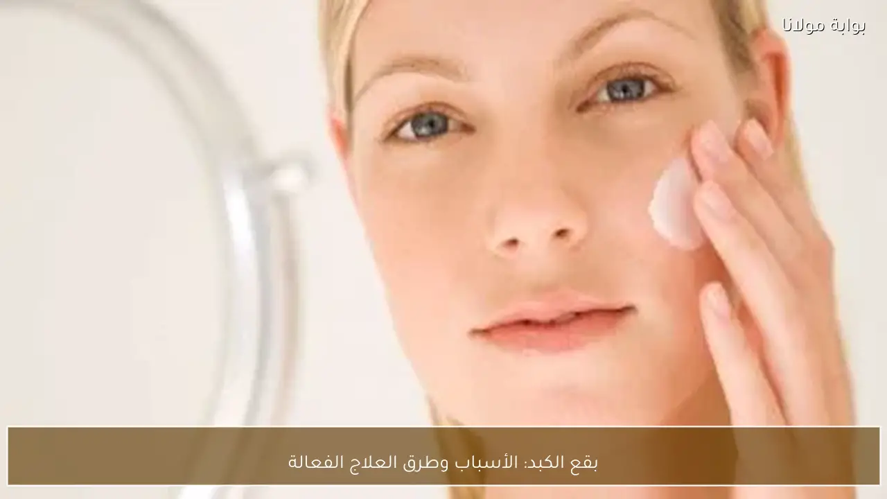 بقع الكبد: الأسباب وطرق العلاج الفعالة