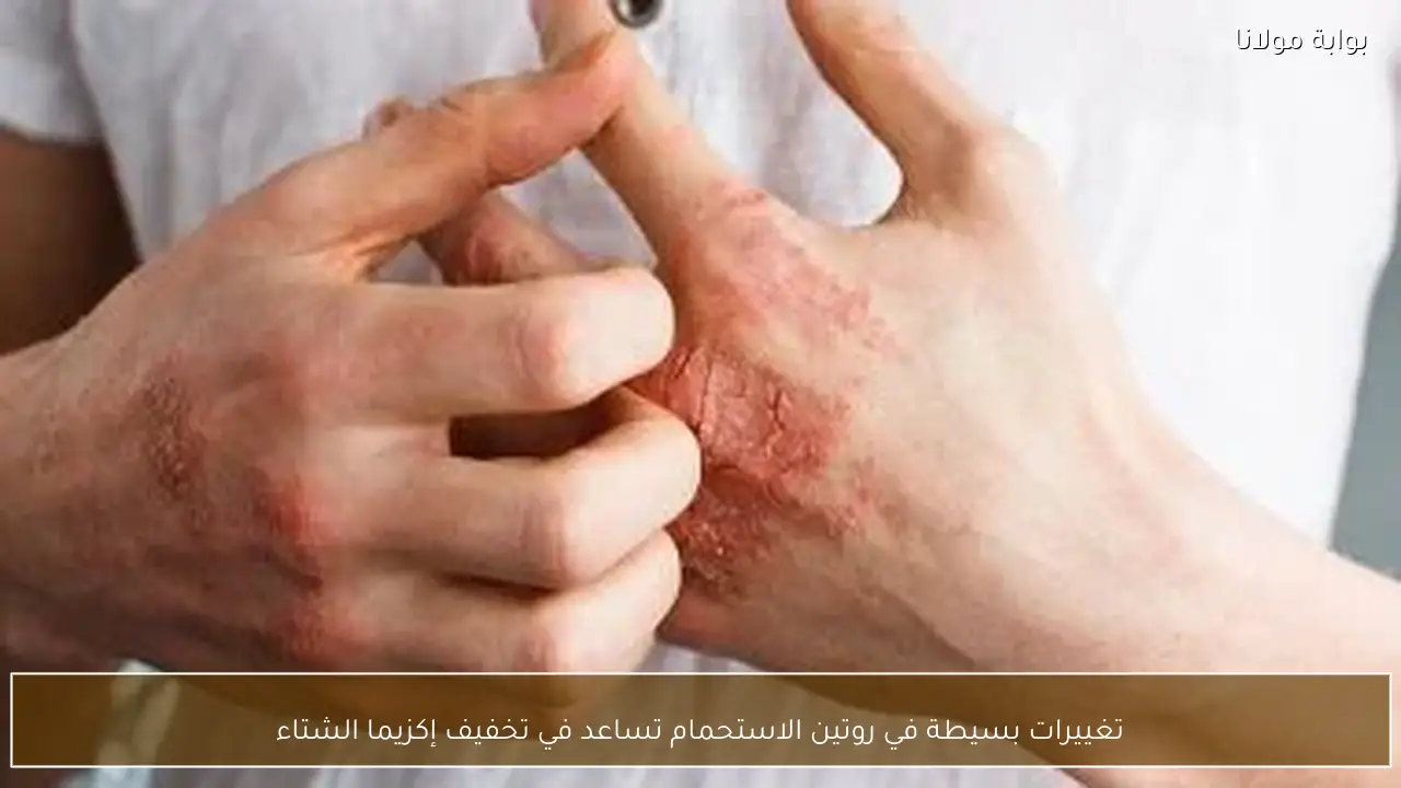 تغييرات بسيطة في روتين الاستحمام تساعد في تخفيف إكزيما الشتاء