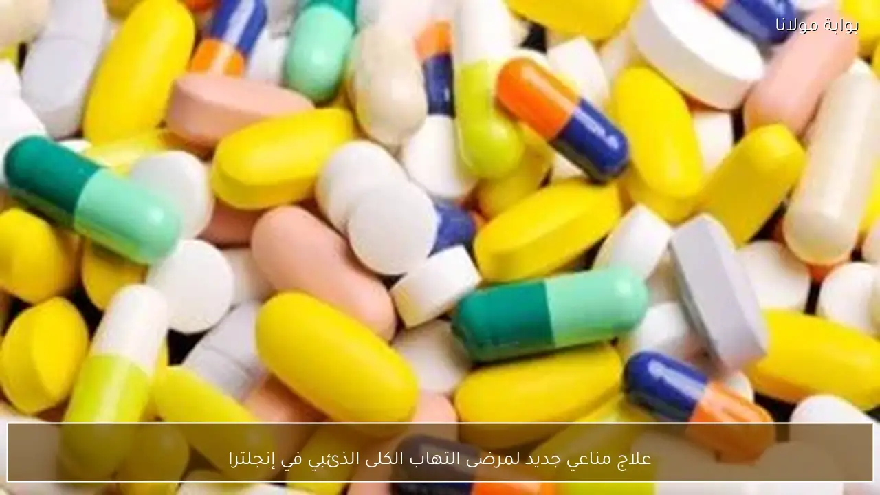 علاج مناعي جديد لمرضى التهاب الكلى الذئبي في إنجلترا