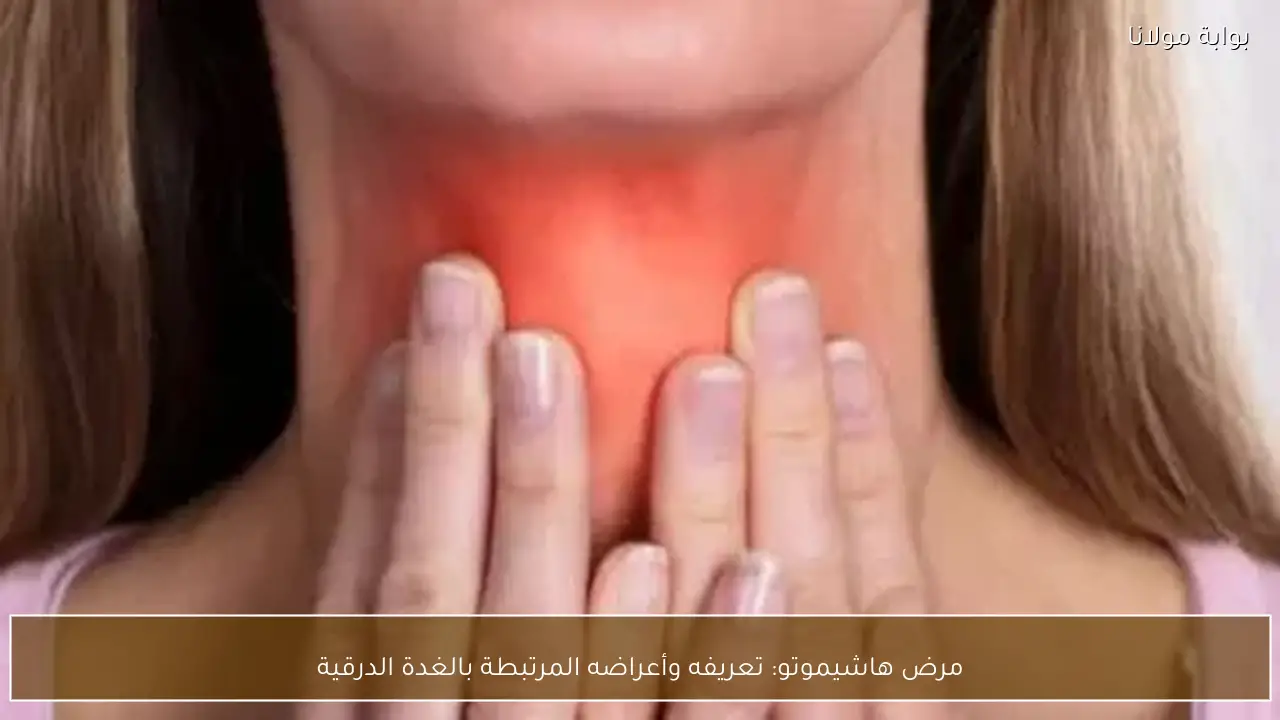 مرض هاشيموتو: تعريفه وأعراضه المرتبطة بالغدة الدرقية