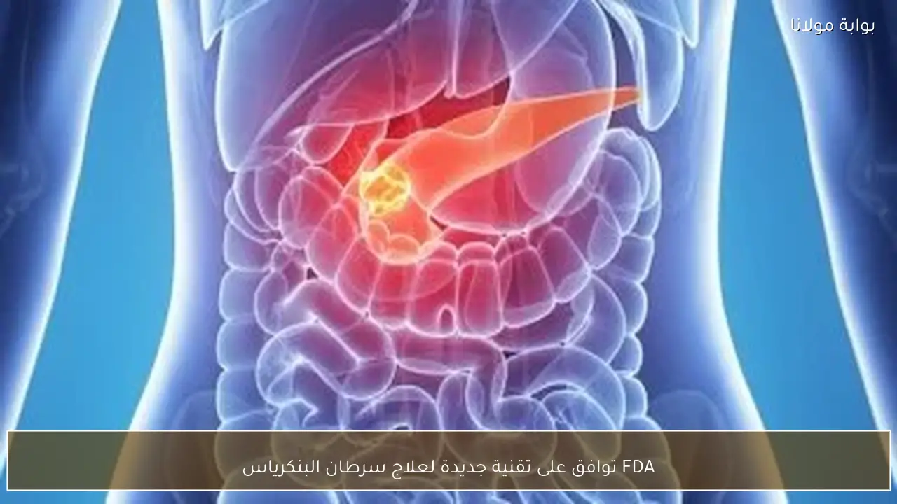 FDA توافق على تقنية جديدة لعلاج سرطان البنكرياس