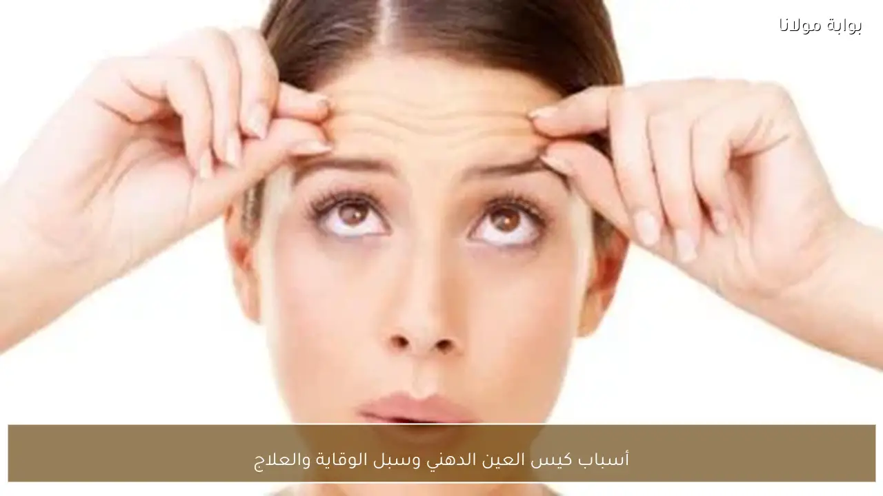 أسباب كيس العين الدهني وسبل الوقاية والعلاج
