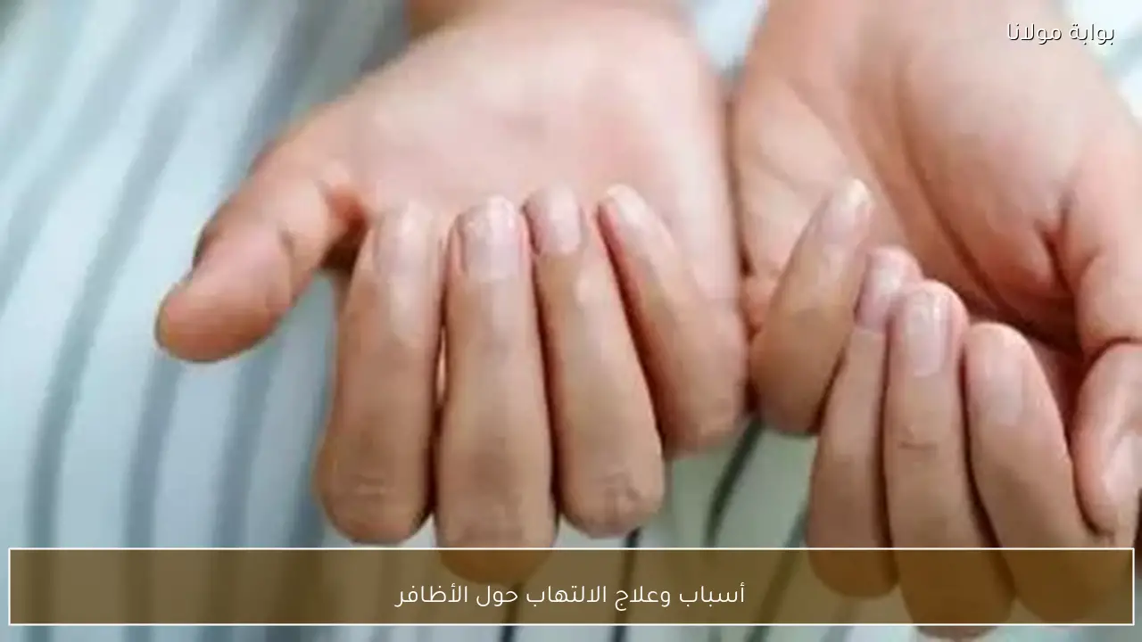 أسباب وعلاج الالتهاب حول الأظافر