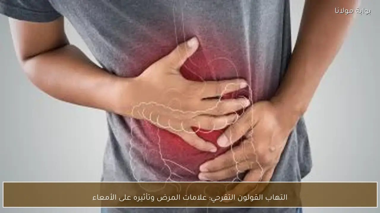 التهاب القولون التقرحي: علامات المرض وتأثيره على الأمعاء