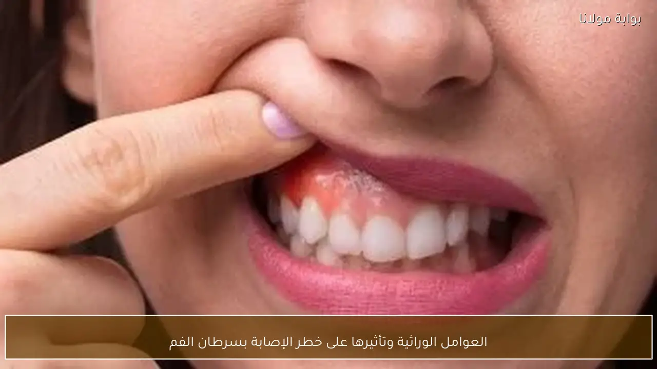 العوامل الوراثية وتأثيرها على خطر الإصابة بسرطان الفم