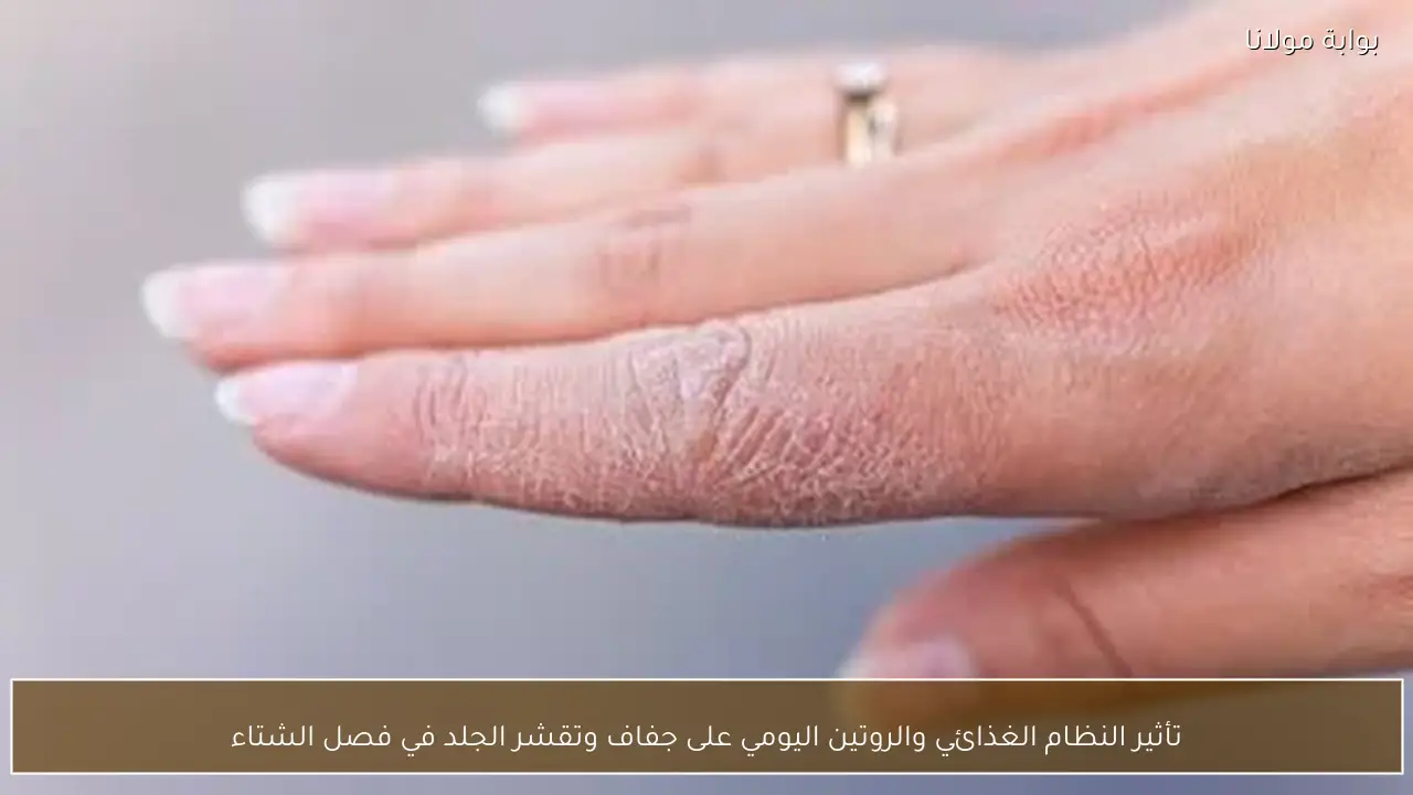 تأثير النظام الغذائي والروتين اليومي على جفاف وتقشر الجلد في فصل الشتاء