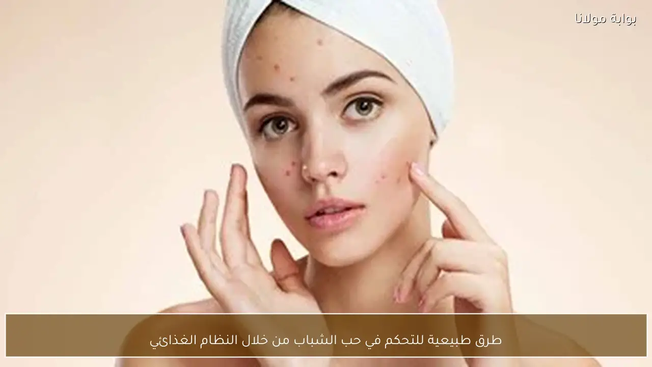 طرق طبيعية للتحكم في حب الشباب من خلال النظام الغذائي