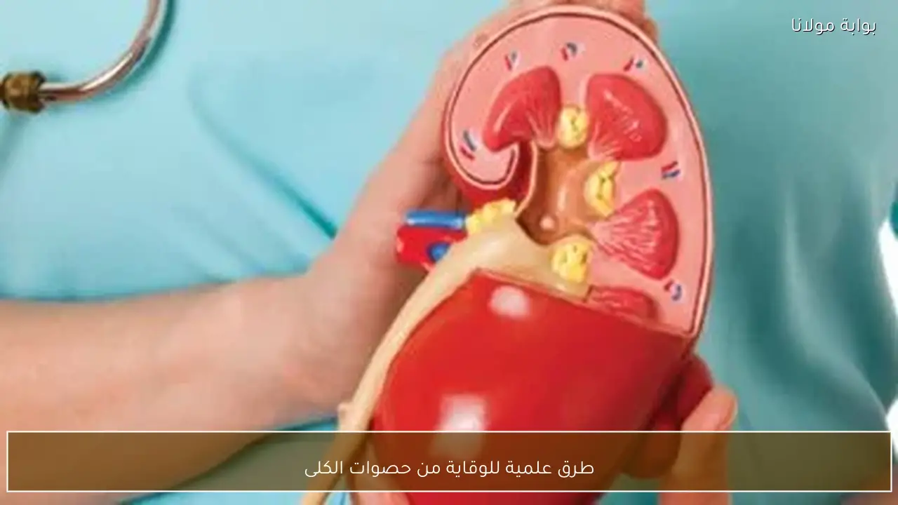 طرق علمية للوقاية من حصوات الكلى