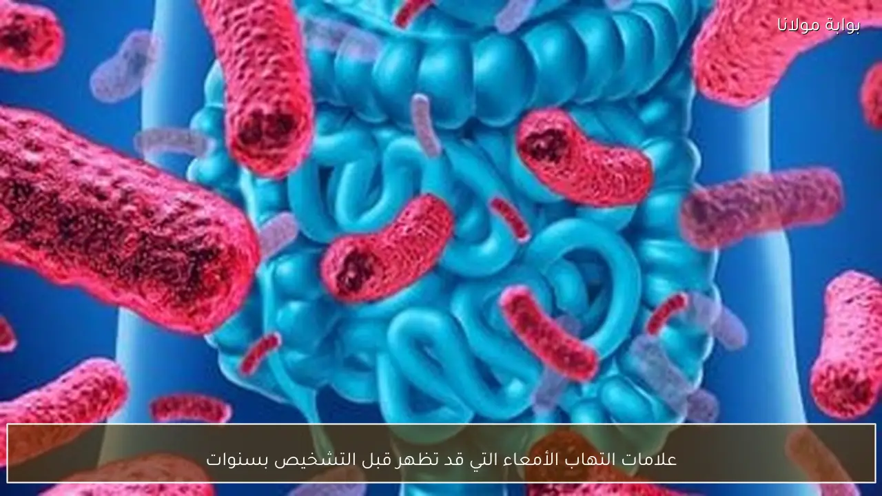 علامات التهاب الأمعاء التي قد تظهر قبل التشخيص بسنوات