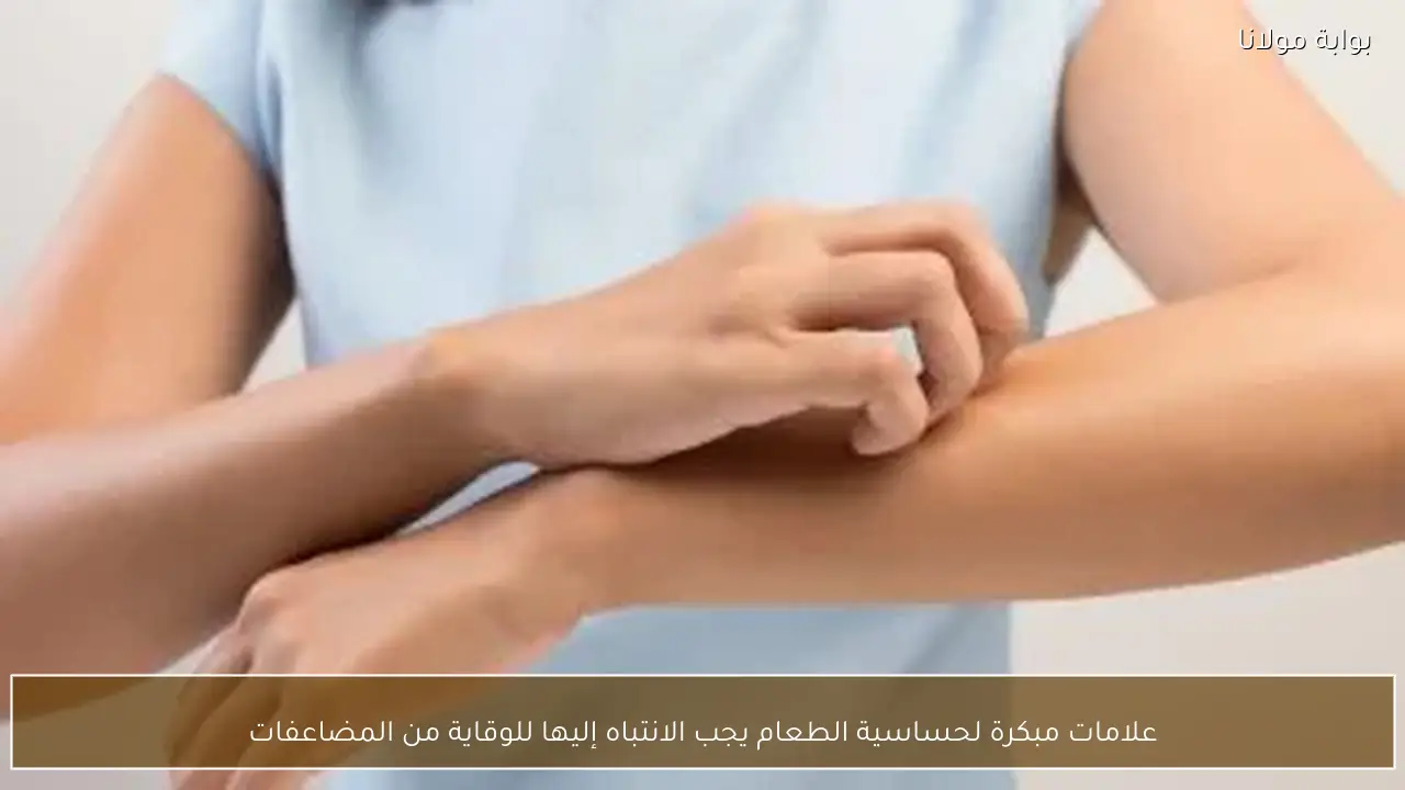 علامات مبكرة لحساسية الطعام يجب الانتباه إليها للوقاية من المضاعفات