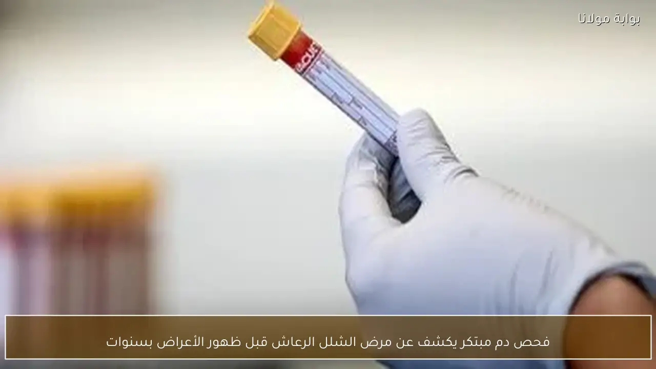 فحص دم مبتكر يكشف عن مرض الشلل الرعاش قبل ظهور الأعراض بسنوات