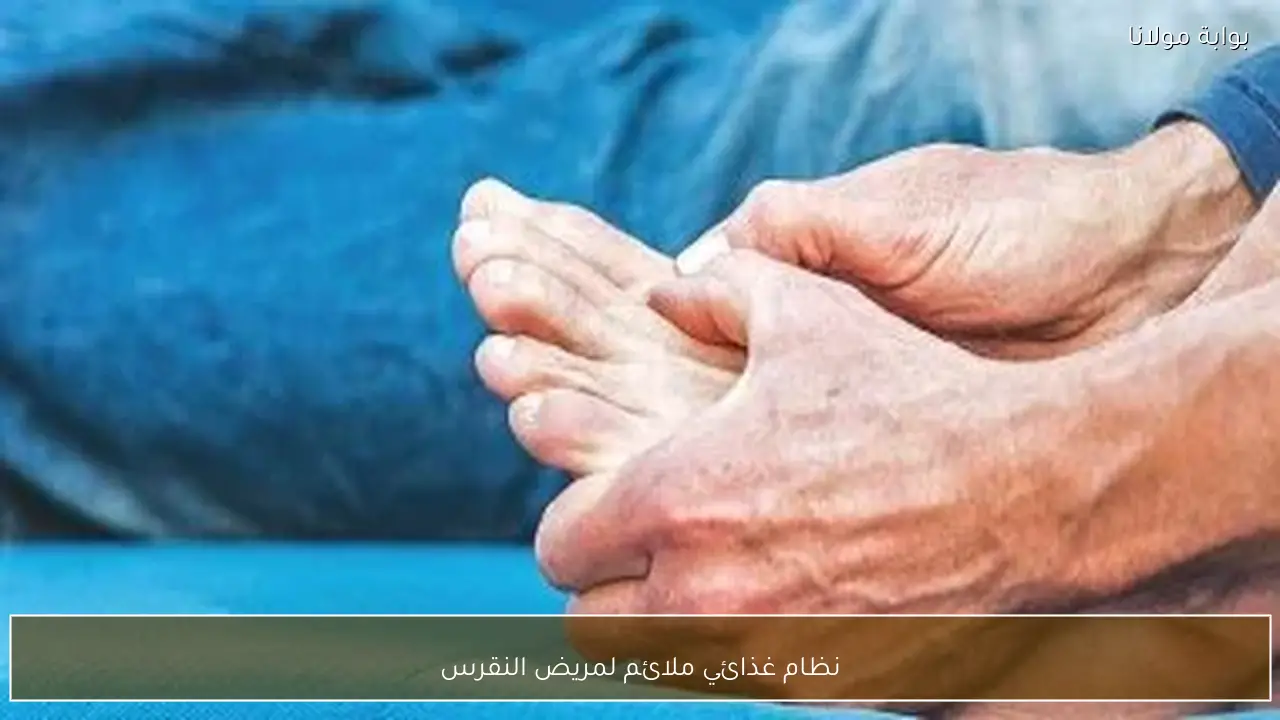 نظام غذائي ملائم لمريض النقرس