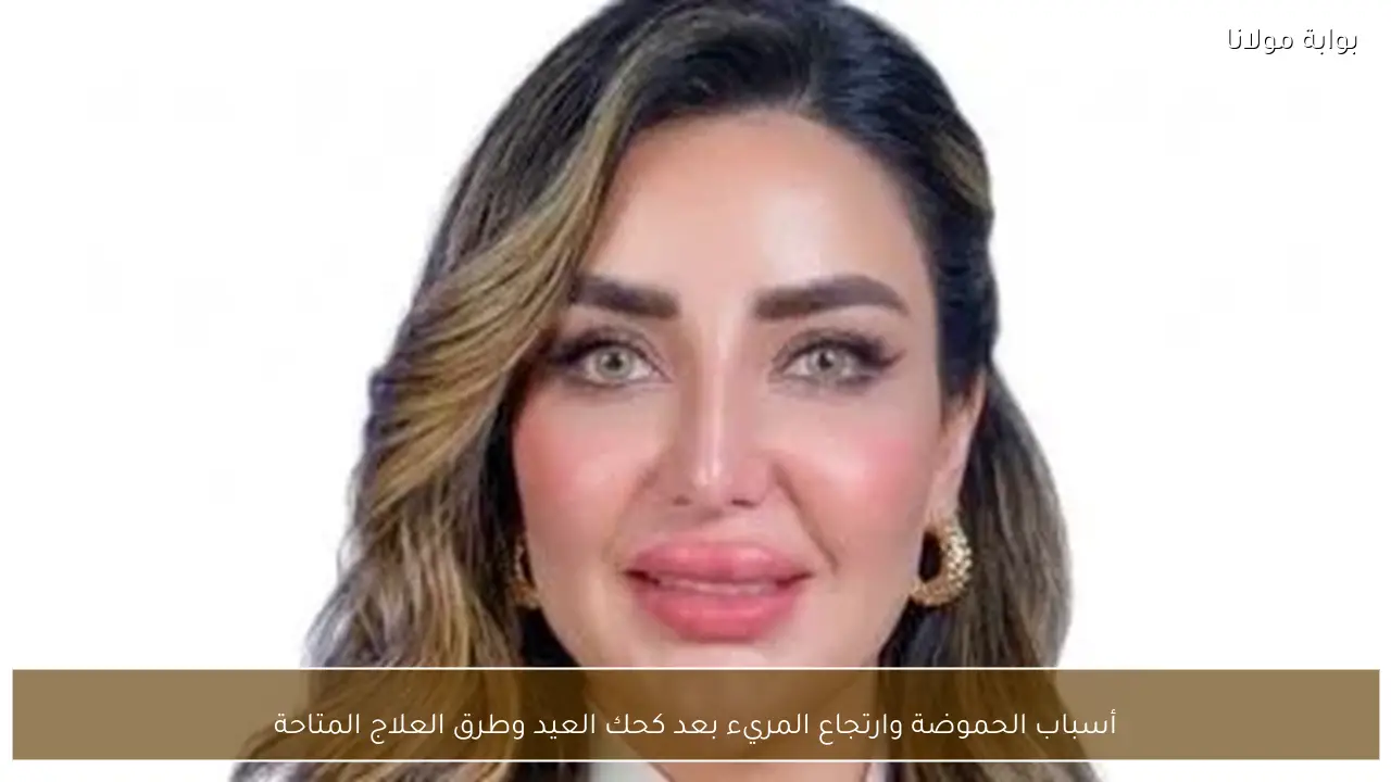 أسباب الحموضة وارتجاع المريء بعد كحك العيد وطرق العلاج المتاحة