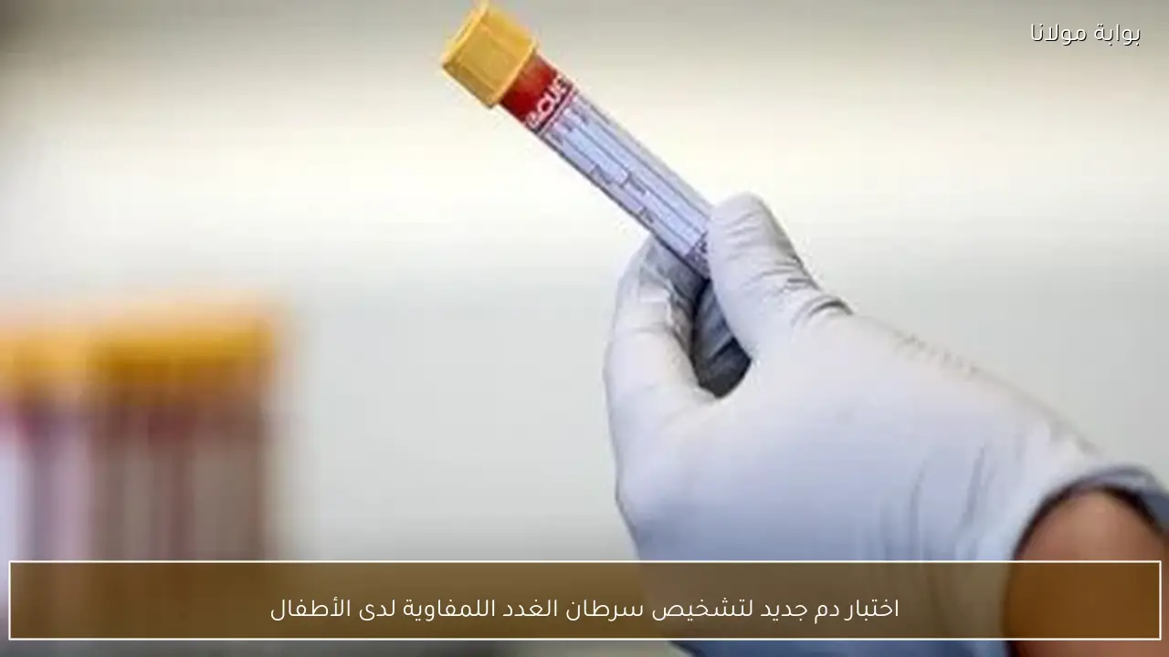 اختبار دم جديد لتشخيص سرطان الغدد اللمفاوية لدى الأطفال