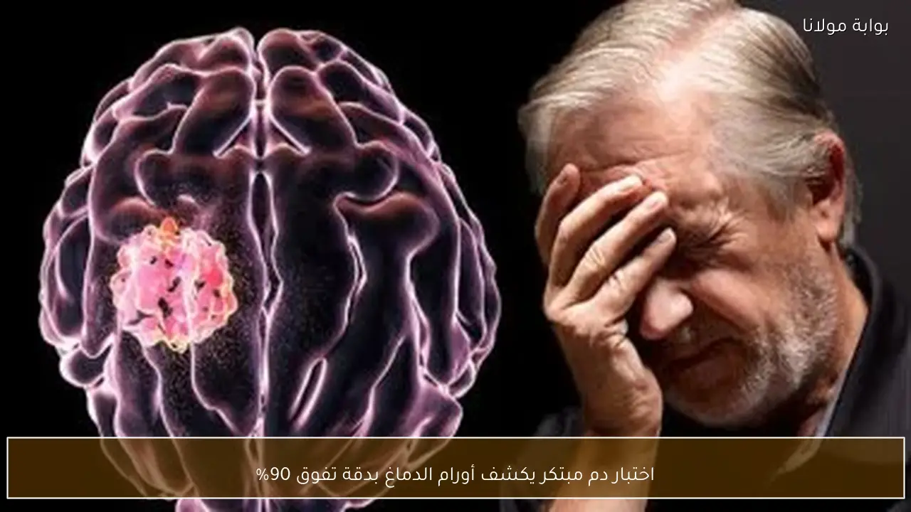اختبار دم مبتكر يكشف أورام الدماغ بدقة تفوق 90%