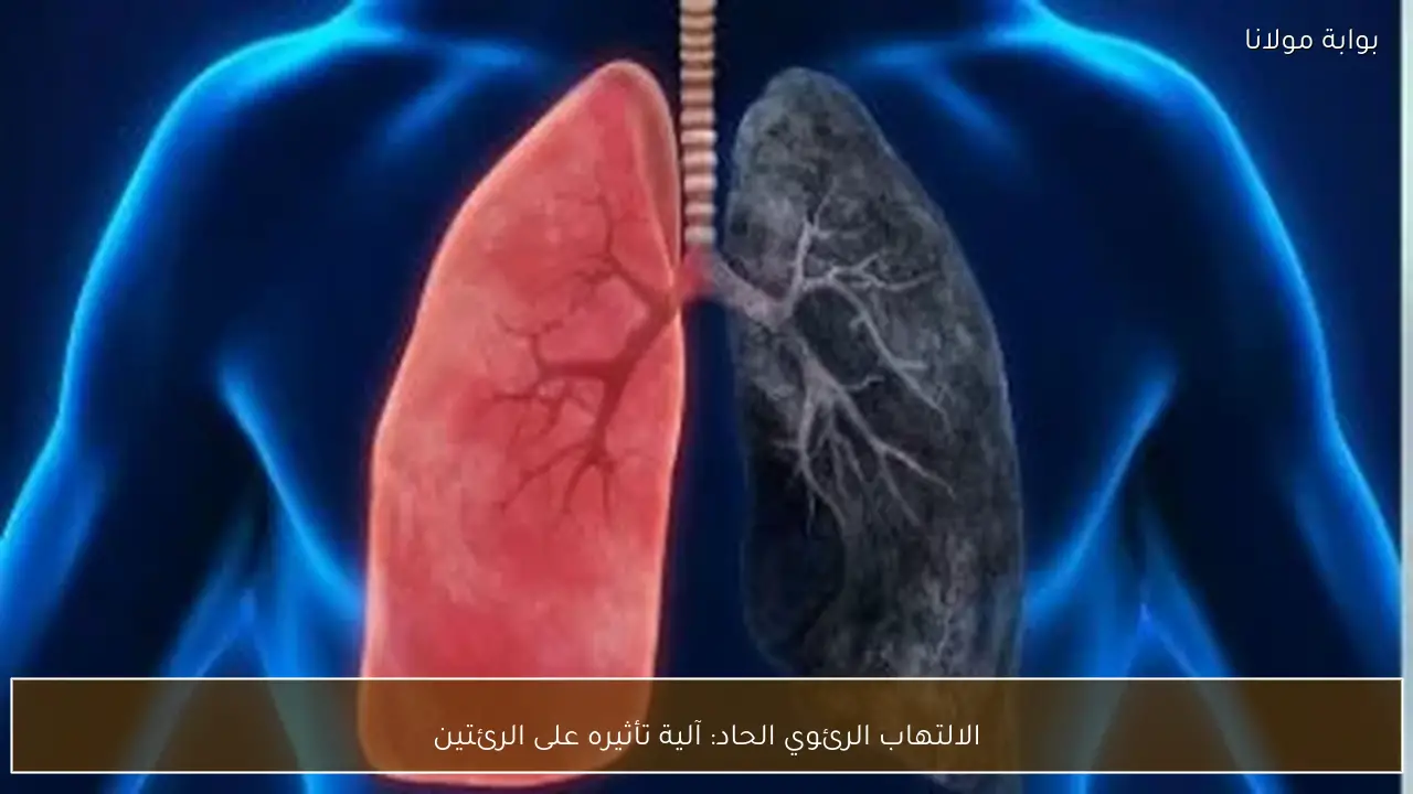 الالتهاب الرئوي الحاد: آلية تأثيره على الرئتين