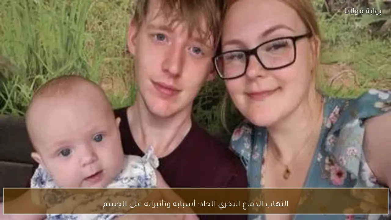 التهاب الدماغ النخري الحاد: أسبابه وتأثيراته على الجسم