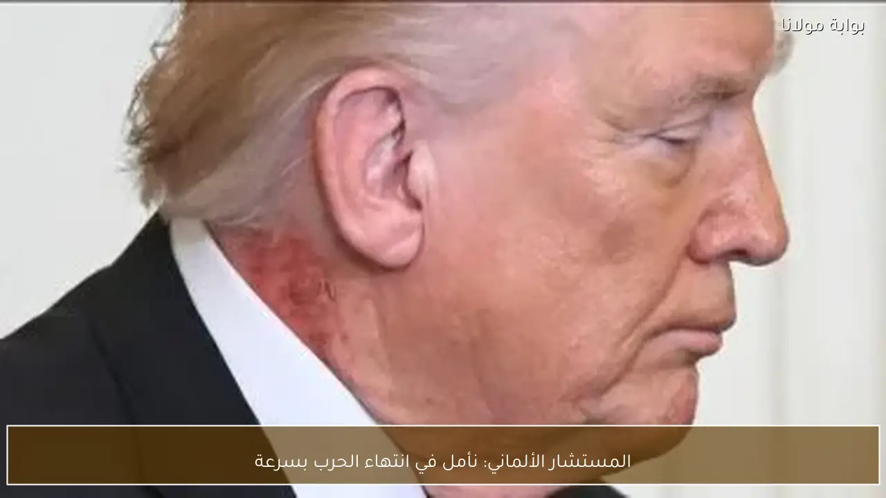 المستشار الألماني: نأمل في انتهاء الحرب بسرعة