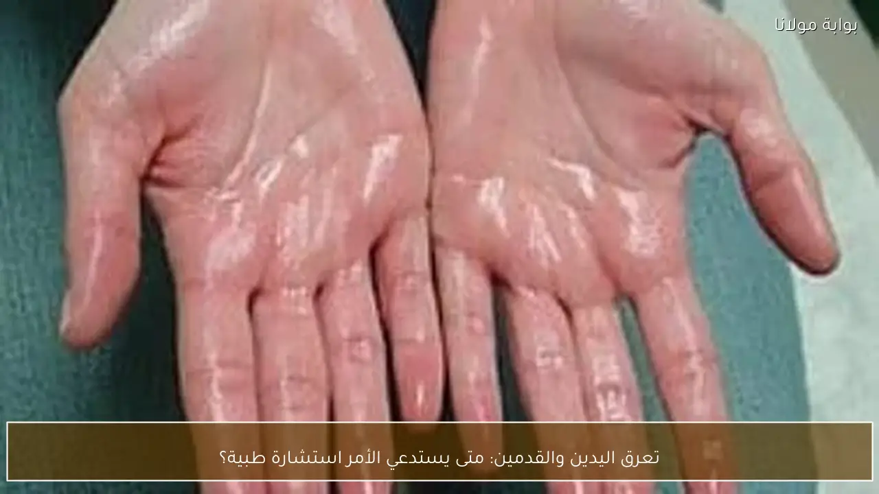 تعرق اليدين والقدمين: متى يستدعي الأمر استشارة طبية؟