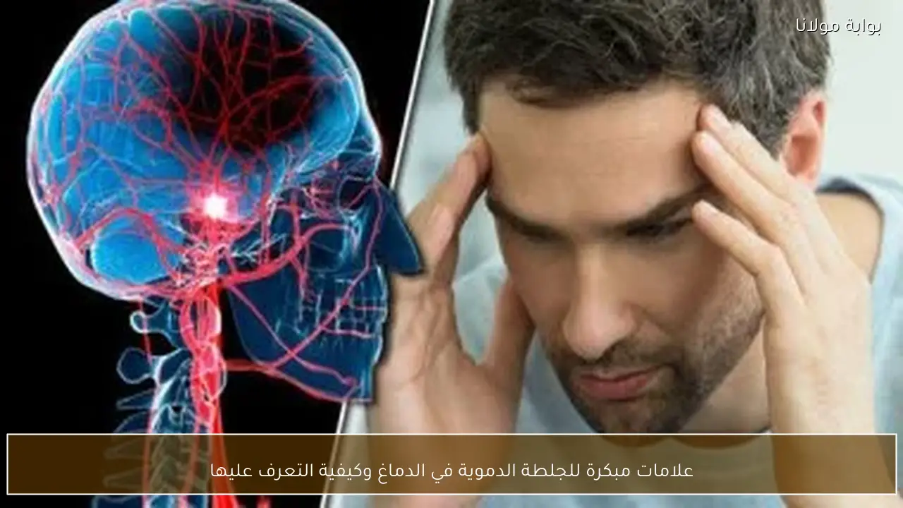 علامات مبكرة للجلطة الدموية في الدماغ وكيفية التعرف عليها