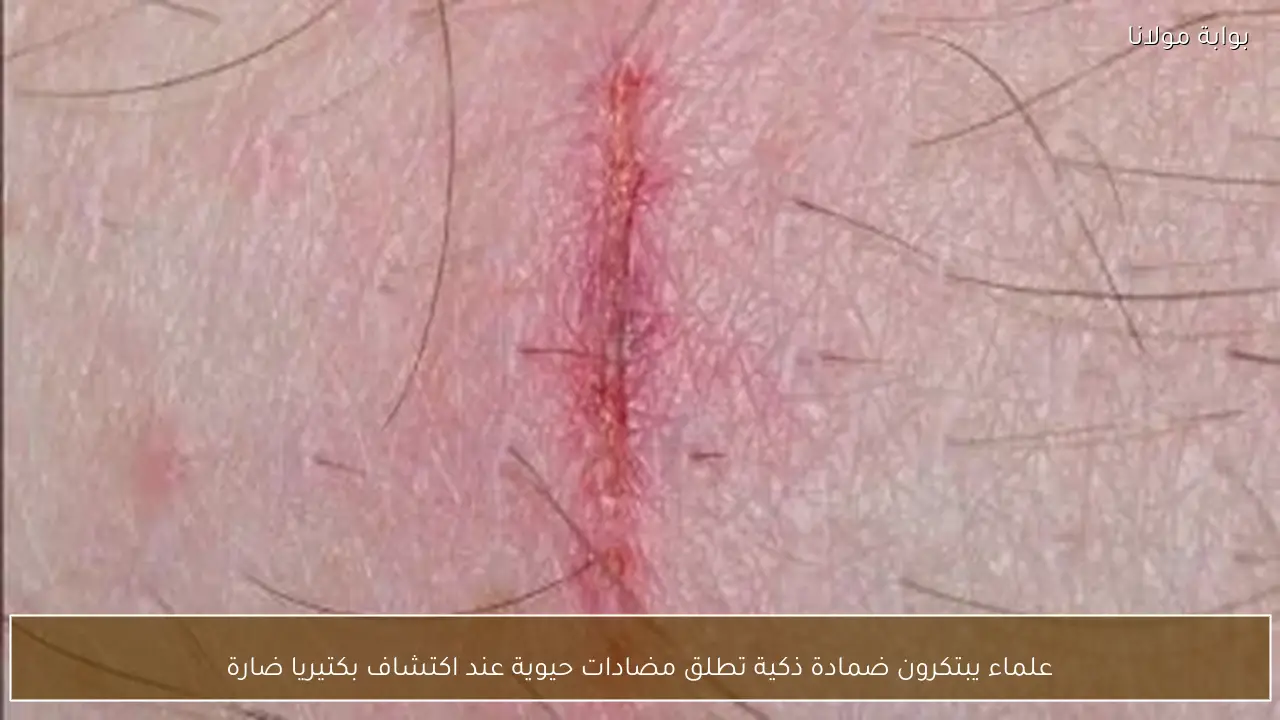 علماء يبتكرون ضمادة ذكية تطلق مضادات حيوية عند اكتشاف بكتيريا ضارة