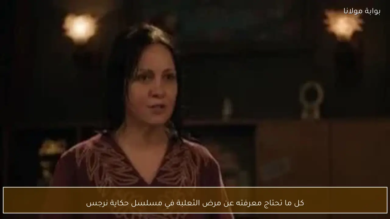 كل ما تحتاج معرفته عن مرض الثعلبة في مسلسل حكاية نرجس